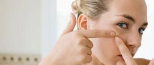 Acne e malessere psicologico