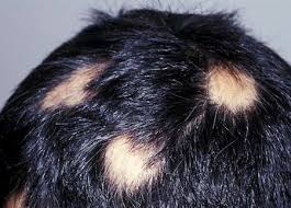 studio psicologia e counseling milano capelli